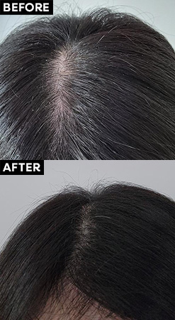 HAIR + SCALP DEEP CLEANSE CONDITIONER FOR SENSITIVE SCALPS AND OILY HAIR